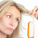 Donna che sta affrontando una perdita significativa di capelli a causa della menopausa.